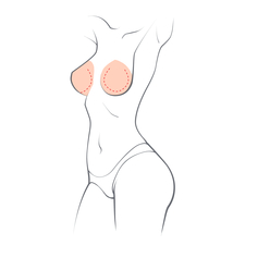 Breast Reduction
